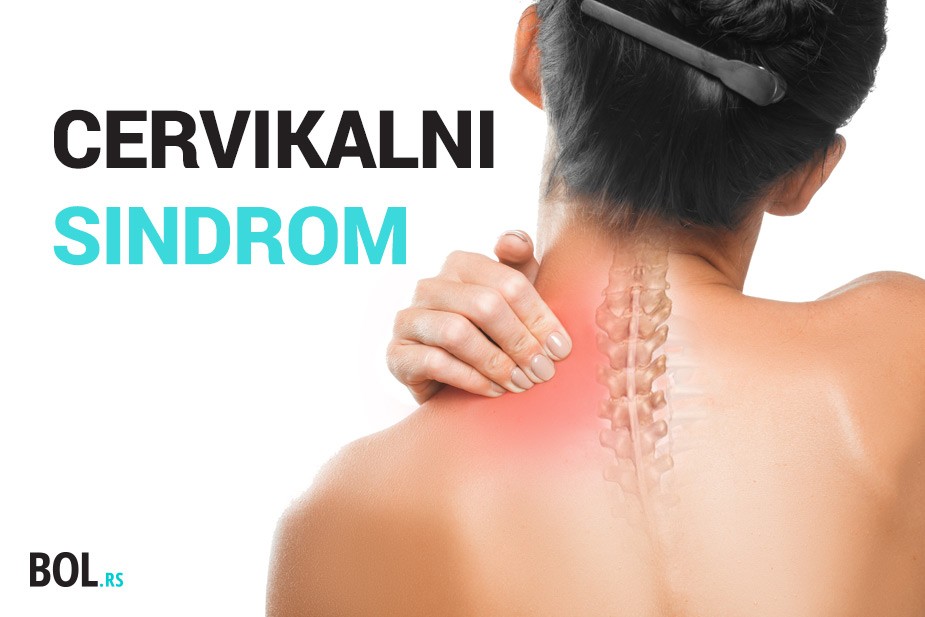 Cervikalni sindrom: Da li vaš vrat mora da pati?