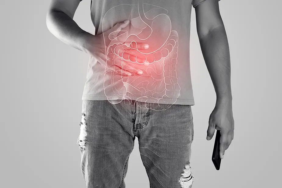 Ulcerozni kolitis: simptomi, uzroci i mogućnosti lečenja