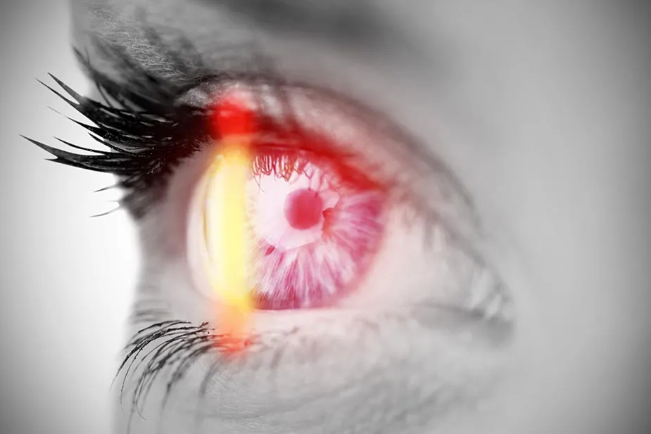Bol u očima: 11 uobičajenih uzroka i šta treba učiniti