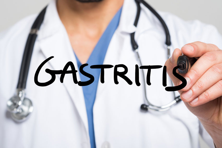 Gastritis izazvan stresom: Simptomi, uzroci i 5 opcija lečenja